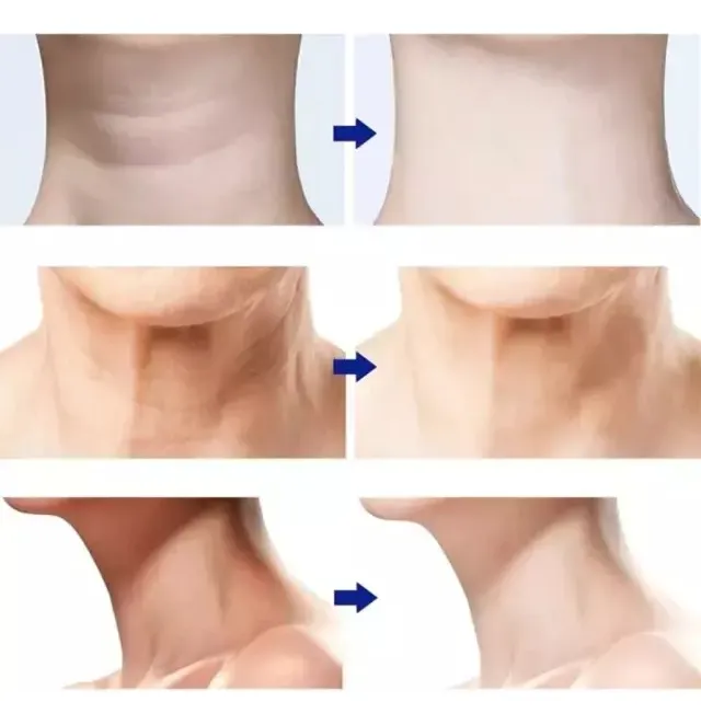 Massageador Facial Rejuvenescedor com Vibração Relaxante - Imagem 6